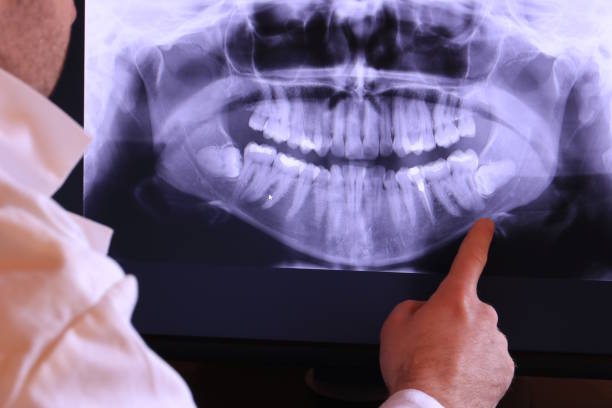Best Holiday Emergency Dentist in Elkins, AR